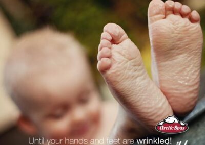 Boy with a wrinkled hands and feet